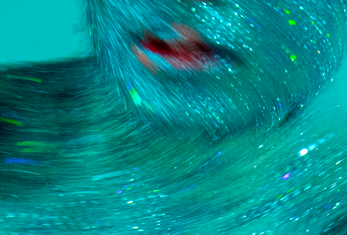 DANCE:ON TURQUOISE (IV)
